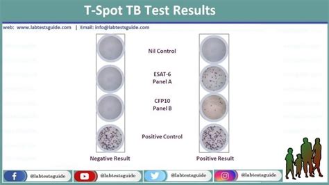 t spot blood test bottle|t spot tb test false positive.